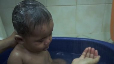 Tavuk Pox'u döküntü (Varisella) hastalığı