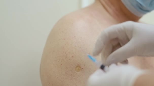 熟練看護師は抗コロナウイルス薬を注射します。Covid 19患者の予防接種. — ストック動画