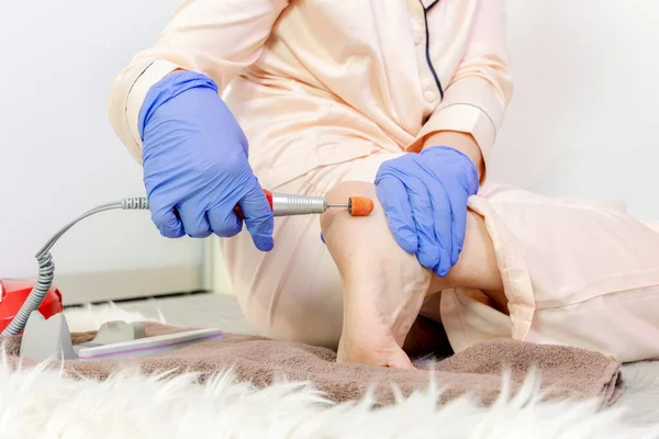 Woman Using Pedicure Machine Remove Foot Calluses — Stock Photo, Image