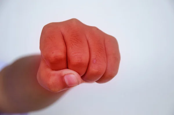 pain of children fist injury  on white background