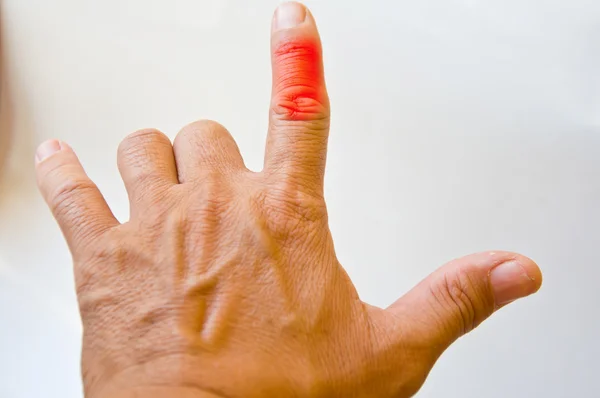 Ból palca punkt — Zdjęcie stockowe