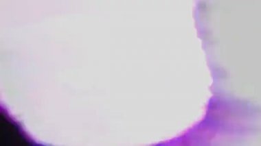 Video Statik Distorsiyon