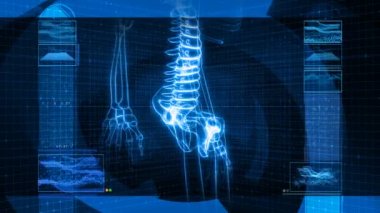 İnsan iskeleti (Hd X-Ray)