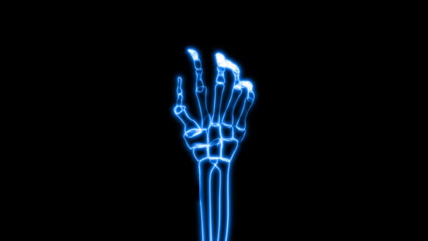 X 射线的人的手抓 (高清) — 图库视频影像