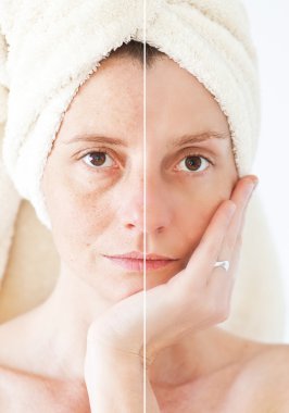Güzellik kavramı - Cilt Bakımı, Anti aging yordamlar, gençleştirme,