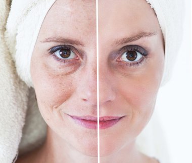 Güzellik kavramı - Cilt Bakımı, Anti aging yordamlar, gençleştirme,