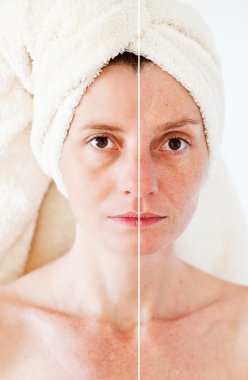 Güzellik kavramı - Cilt Bakımı, Anti aging yordamlar, gençleştirme,