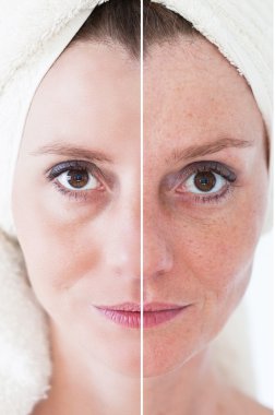 Güzellik kavramı - Cilt Bakımı, Anti aging yordamlar, gençleştirme,