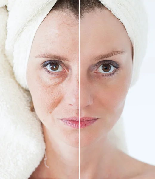 Güzellik kavramı - Cilt Bakımı, Anti aging yordamlar, gençleştirme, — Stok fotoğraf