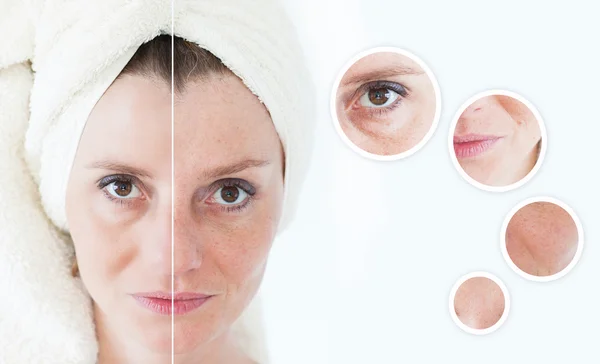 Güzellik kavramı - Cilt Bakımı, Anti aging yordamlar, gençleştirme,
