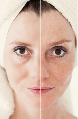 Güzellik kavramı - Cilt Bakımı, Anti aging yordamlar, gençleştirme,