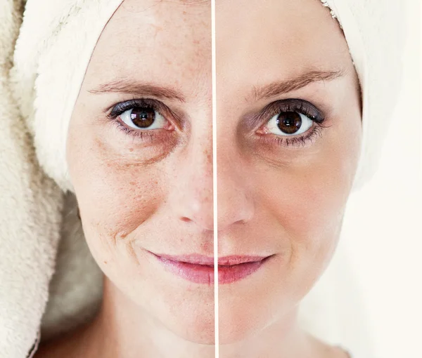 Güzellik kavramı - Cilt Bakımı, Anti aging yordamlar, gençleştirme,