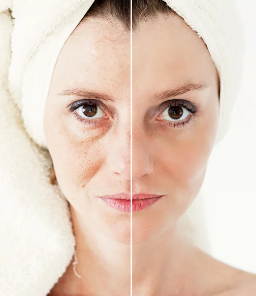Güzellik kavramı - Cilt Bakımı, Anti aging yordamlar, gençleştirme,