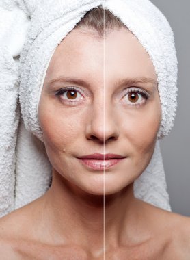 Güzellik kavramı - Cilt Bakımı, Anti aging yordamlar, gençleştirme,