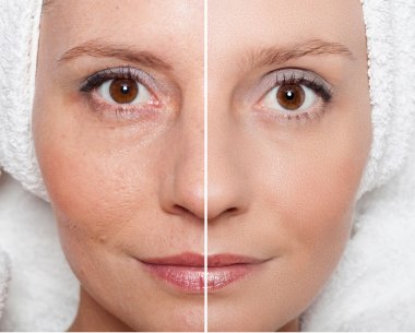 Güzellik kavramı - Cilt Bakımı, Anti aging yordamlar, gençleştirme,