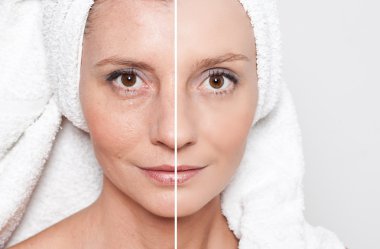 Güzellik kavramı - Cilt Bakımı, Anti aging yordamlar, gençleştirme,