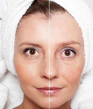 Güzellik kavramı - Cilt Bakımı, Anti aging yordamlar, gençleştirme,