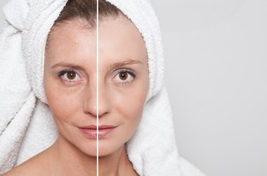 Güzellik kavramı - Cilt Bakımı, Anti aging yordamlar, gençleştirme,