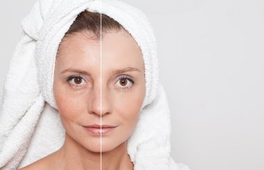 Güzellik kavramı - Cilt Bakımı, Anti aging yordamlar, gençleştirme,