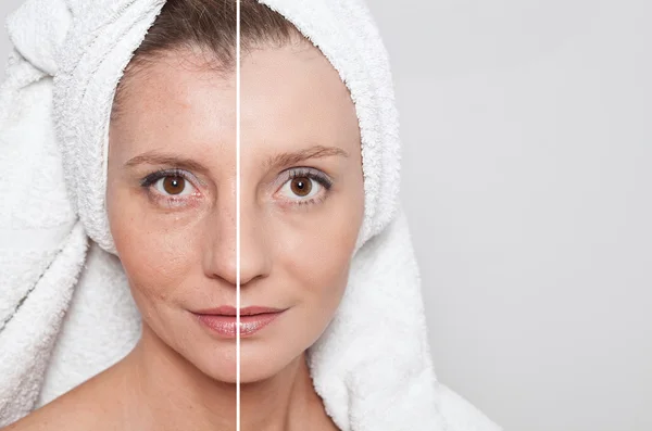 Concept beauté - soin de la peau, procédures anti-âge, rajeunissement , — Photo