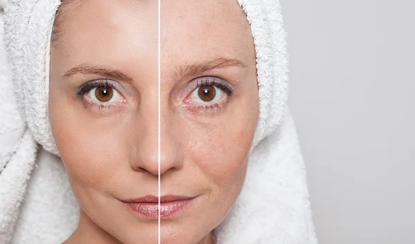 Güzellik kavramı - Cilt Bakımı, Anti aging yordamlar, gençleştirme, — Stok fotoğraf