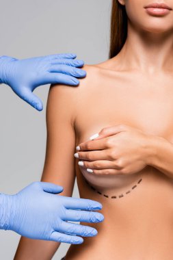 Plastik eldivenli estetik cerrahın çıplak bir kadına dokunuşunun görüntüsü. Gri göğüslerinde izler var. 