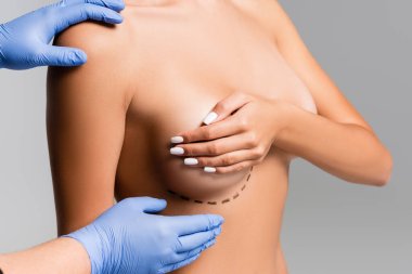 Cropped view of plastic surgeon touching naked woman with lines on breast isolated on grey  clipart