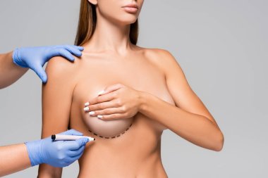 Cropped view of doctor holding marker near bust of naked woman with marks isolated on grey  clipart