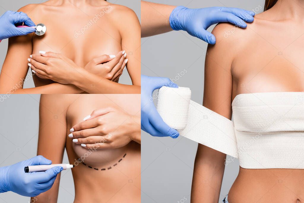 Collage of doctor holding marker, stethoscope and elastic bandage near breast of naked woman isolated on grey 