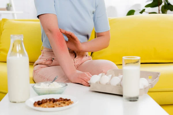 Vista Cortada Mulher Com Alergia Sentado Perto Comida Primeiro Plano — Fotografia de Stock