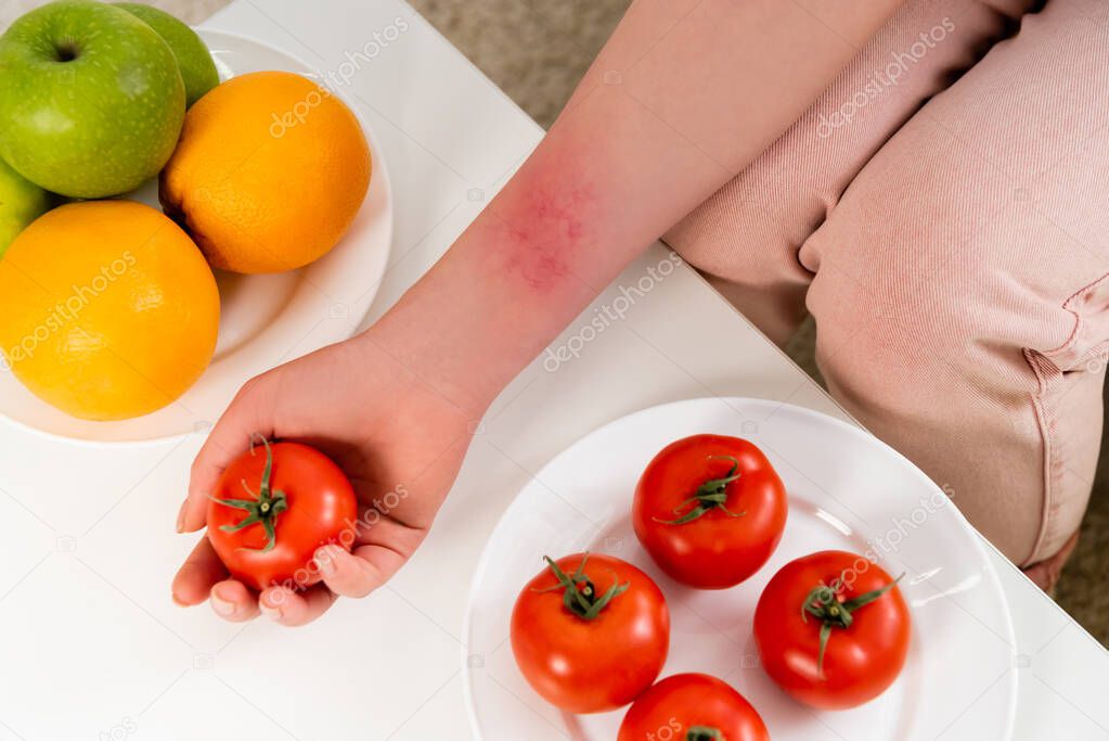 Cropped view of woman with allergy reaction holding tomato near fruits 
