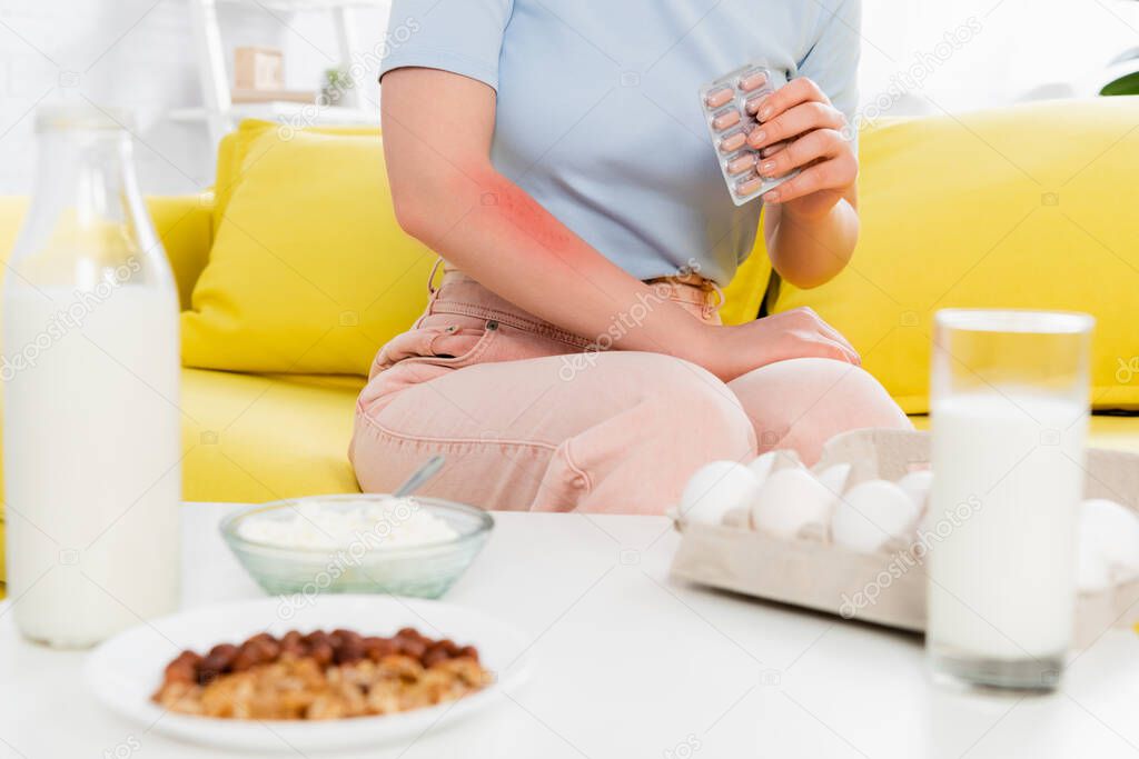 Cropped view of woman with allergy holding pills near food and milk on blurred foreground 