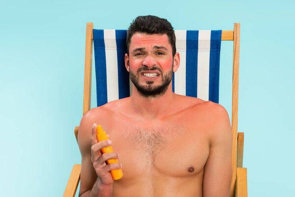 Worried shirtless man with sunburn holding sunscreen isolated on blue 