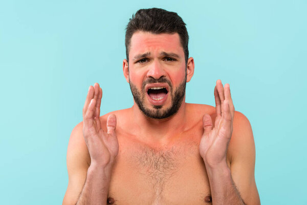 Tensed man with sunburn looking at camera isolated on blue 