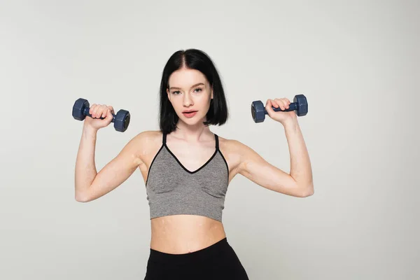 Sportvrouw Met Vitiligo Training Met Halters Geïsoleerd Grijs — Stockfoto