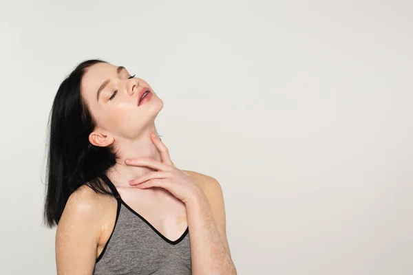 Deportiva Con Vitiligo Ojos Cerrados Tocando Cuello Aislado Gris — Foto de Stock