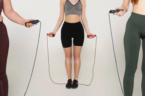 Cropped View Sportswoman Vitiligo Holding Jump Rope Friends Grey Background — Stock Photo, Image