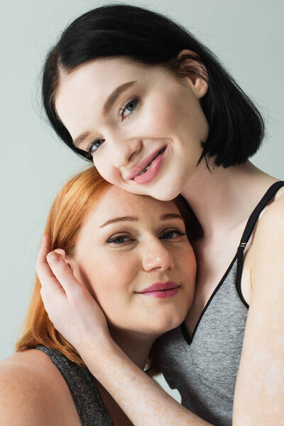 Улыбающаяся спортсменка с витилиго объятия плюс размер друга изолированы на серый 