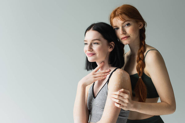 Red haired sportswoman hugging smiling friend with vitiligo isolated on grey 
