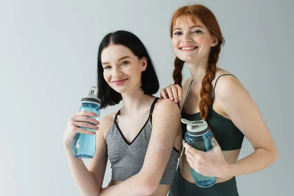 Deportistas Alegres Con Vitiligo Pecas Sosteniendo Botellas Deportivas Aisladas Gris — Foto de Stock