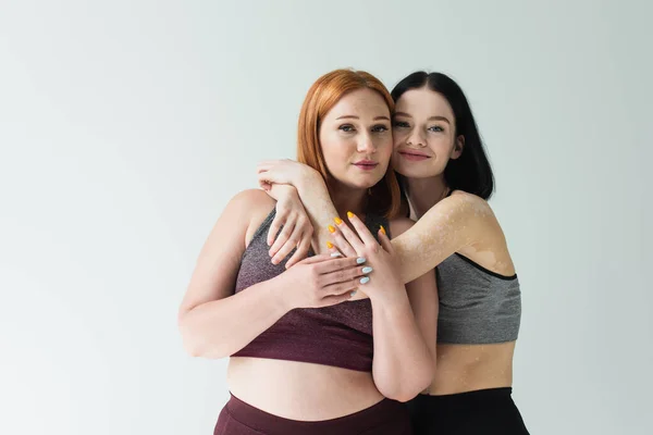 Sportswoman Vitiligo Hugging Body Positive Friend Isolated Grey — Stock Photo, Image