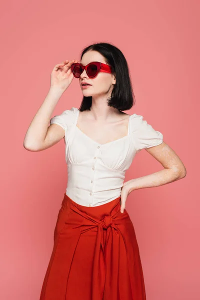 Stylish Woman Vitiligo Holding Sunglasses Isolated Pink — Stock Photo, Image