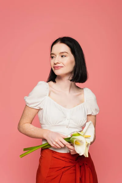 Mujer Con Vitiligo Sosteniendo Flores Aisladas Rosa — Foto de Stock