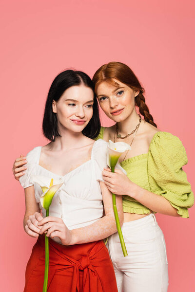 Веснушка держит калла Лили рядом стильный друг с витилиго изолированы на розовый 