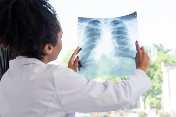 Blurred African American Doctor Holding Fluorography Clinic — Stock Photo, Image