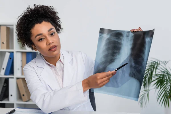 Afrikanischer Arzt Zeigt Auf Fluorographie Während Die Kamera Schaut — Stockfoto