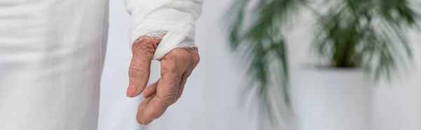 Vue Recadrée Femme Âgée Avec Bandage Plâtre Sur Bras Blessé — Photo