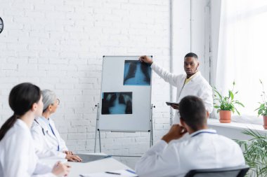 Afrika kökenli Amerikalı doktor konsey sırasında bulanık meslektaşlarının röntgenlerine işaret ediyor.