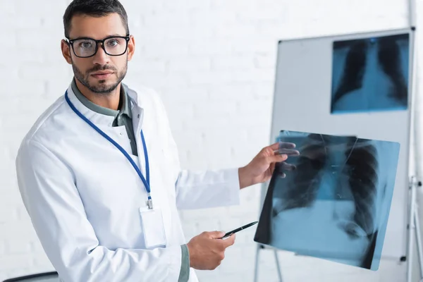 Νεαρός Γιατρός Γυαλιά Που Δείχνουν Στους Πνεύμονες Ακτινογραφία Ενώ Κοιτάζοντας — Φωτογραφία Αρχείου