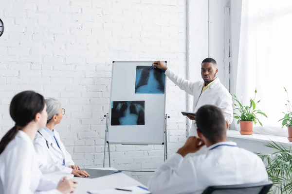 Médico Afroamericano Señalando Los Pulmones Rayos Cerca Colegas Borrosos Durante — Foto de Stock